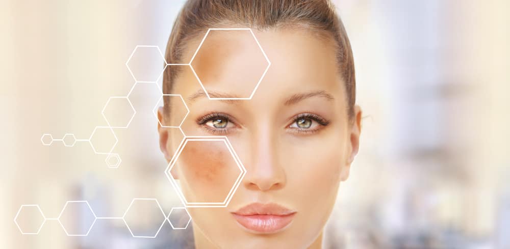 piel-manchas-cuidado